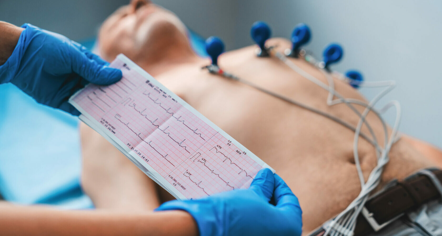 ECG