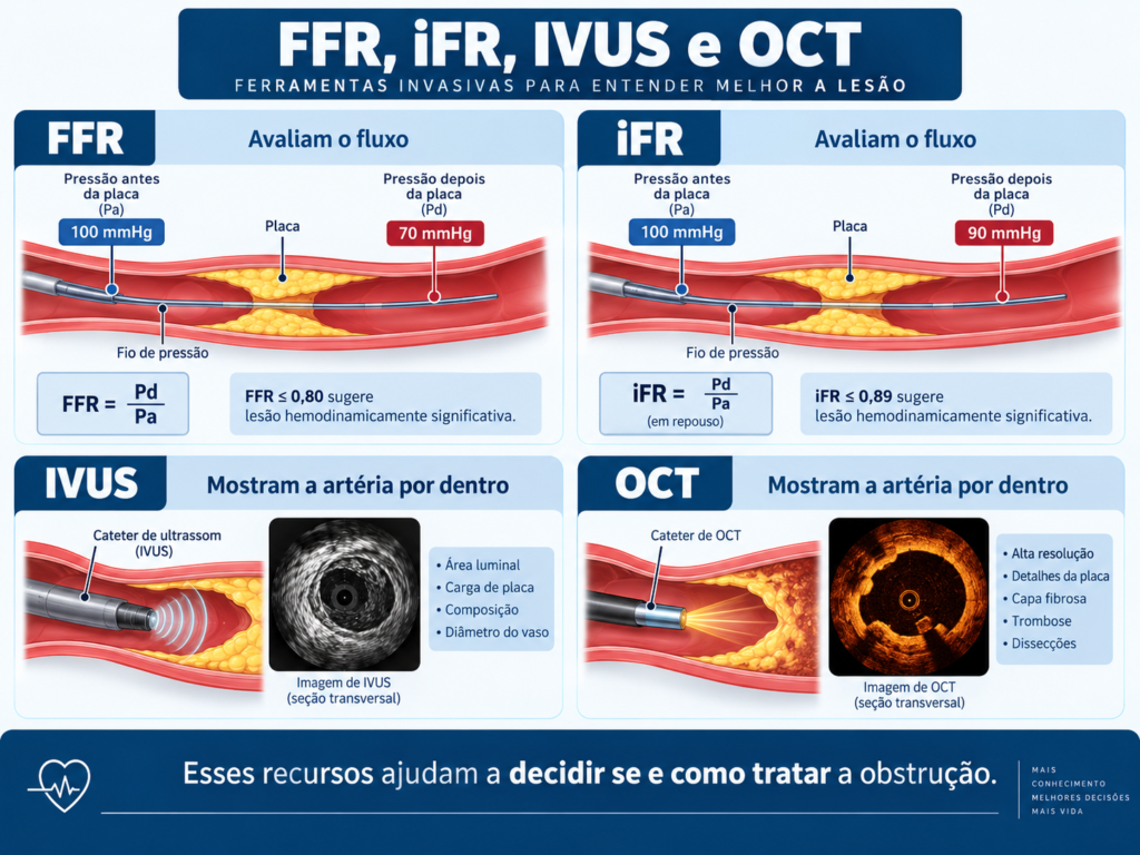 FFR