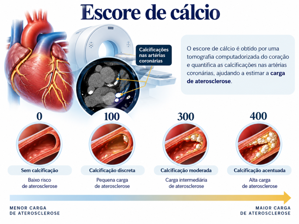escore de calcio